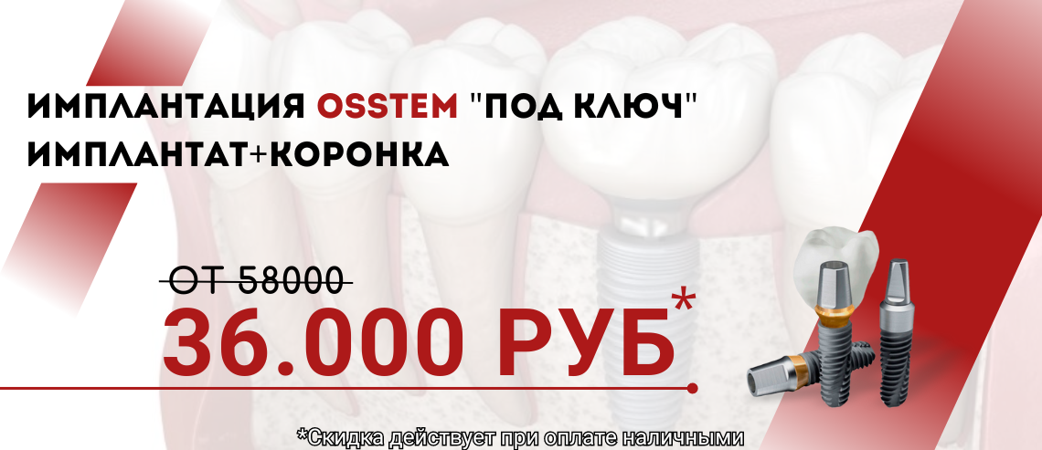 ИМПЛАНТАЦИЯ OSSTEM 